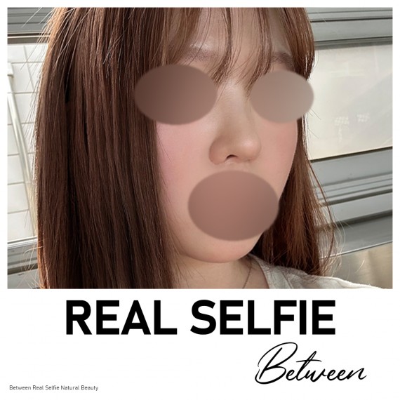 비…